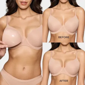 Invisible Lift Inserts