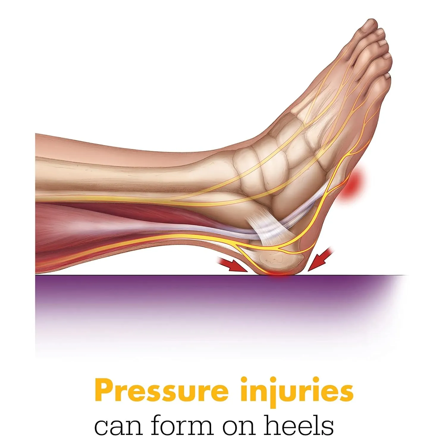 Sage Prevalon® Heel Protector II for Heel Pressure Relief